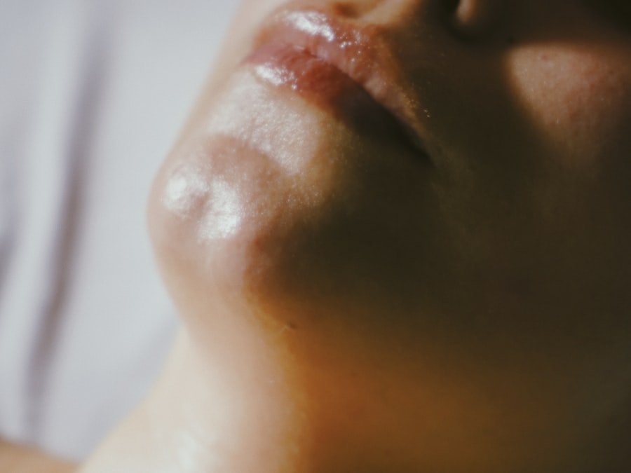 Antes y después de limpieza facial profunda